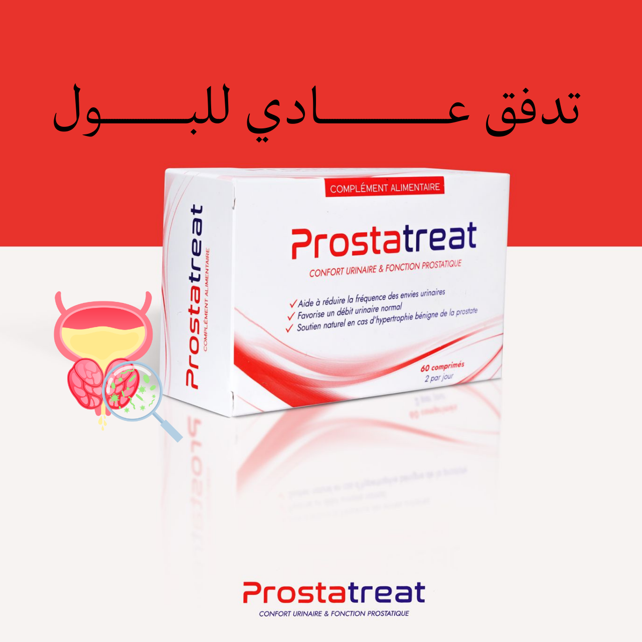 Prostatreat